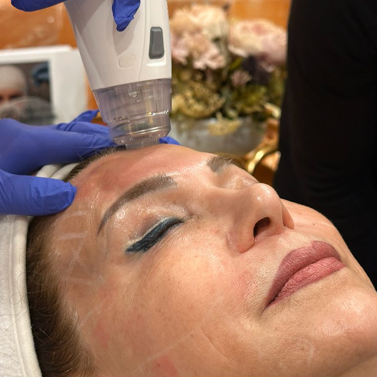 Anti Aging Treatments Burnaby